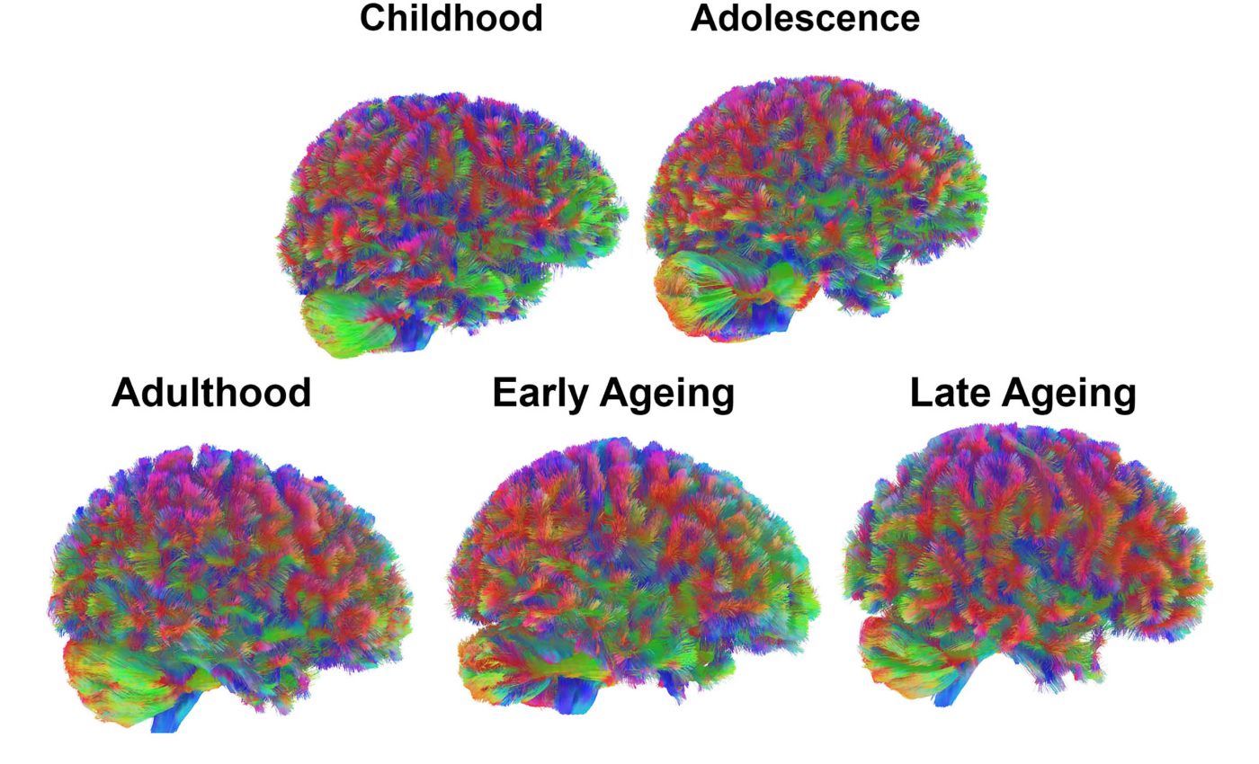 Four Crucial Ages Identified As Turning Points In Human Brain Development